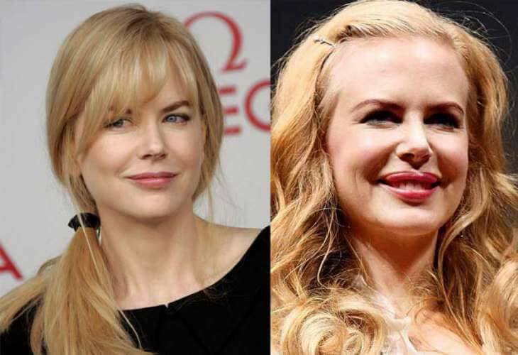 Nicole Kidman